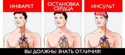 Інсульт, інфаркт і зупинка серця - відмінності і їх симптоми (інсульт) Інсульт, інфаркт і зупинка серця - відмінності і їх симптоми