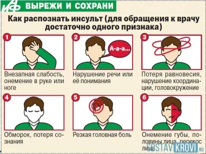 Інсульт стовбура головного мозку ішемічний, геморагічний, чи можливо одужання, самий (головного) Інсульт стовбура головного мозку ішемічний, геморагічний, чи можливо одужання, самий