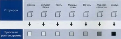 Як Новомосковскть рентгенівські знімки легень, хребта, пазух носа (знімки) Як Новомосковскть рентгенівські знімки легень, хребта, пазух носа