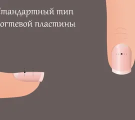 Які помилки існують в моделюванні нігтів (існують) Які помилки існують в моделюванні нігтів