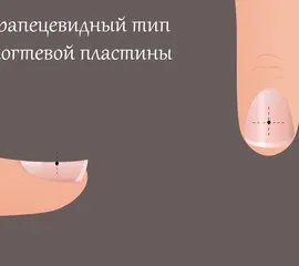 Які помилки існують в моделюванні нігтів (помилки) Які помилки існують в моделюванні нігтів