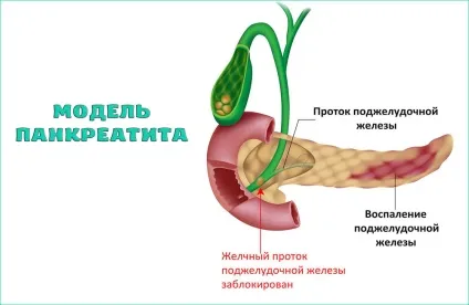 Які можуть бути ускладнення у гастриту (можуть) Які можуть бути ускладнення у гастриту