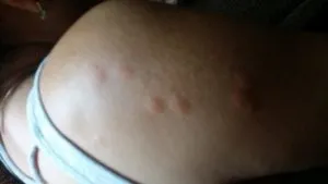 Як позбутися від клопів в дивані самостійно що робити (клопів) Як позбутися від клопів в дивані самостійно що робити