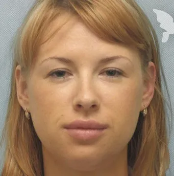 Як позбутися від зморшок на обличчі в домашніх умовах ефективний засіб николас Перрікон, (позбутися) Як позбутися від зморшок на обличчі в домашніх умовах ефективний засіб николас Перрікон,