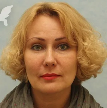 Як позбутися від зморшок на обличчі в домашніх умовах ефективний засіб николас Перрікон, (ефективне) Як позбутися від зморшок на обличчі в домашніх умовах ефективний засіб николас Перрікон,