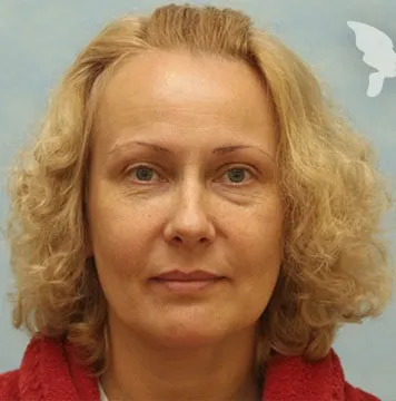 Як позбутися від зморшок на обличчі в домашніх умовах ефективний засіб николас Перрікон, (ефективне) Як позбутися від зморшок на обличчі в домашніх умовах ефективний засіб николас Перрікон,