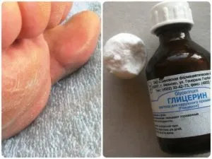 Як лікувати грибок на ногах в домашніх умовах за допомогою аптечних і народних засобів, грибкові (лікування грибка на ногах в домашніх умовах) Як лікувати грибок на ногах в домашніх умовах за допомогою аптечних і народних засобів, грибкові