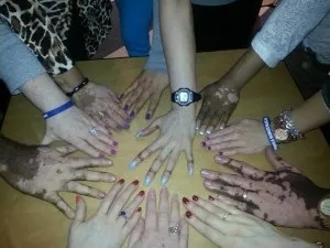 Як зупинити поширення вітіліго (зупинити) Як зупинити поширення вітіліго