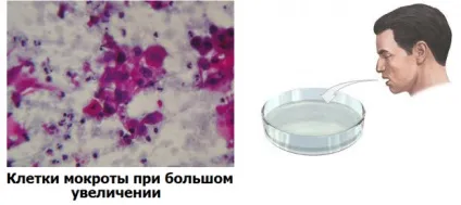 Як визначити рак легенів (органів грудної клітини) Як визначити рак легенів