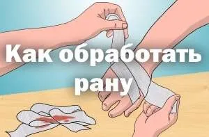 Як правильно обробити рану в домашніх умовах, ніж можна промити відкриту або гнійну - відео (умовах) Як правильно обробити рану в домашніх умовах, ніж можна промити відкриту або гнійну - відео