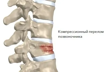 Як проводиться магнітно-резонансна томографія хребта (магнітно-резонансна) Як проводиться магнітно-резонансна томографія хребта