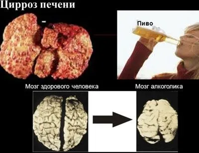 Крапельниці для виведення з запою склад і позитивний ефект (склад) Крапельниці для виведення з запою склад і позитивний ефект