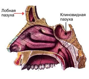 Кіста клиноподібної пазухи симптоми і видалення освіти (клиноподібна пазуха) Кіста клиноподібної пазухи симптоми і видалення освіти