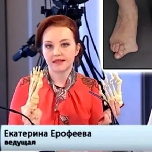 Силіконова накладка на великий палець ноги від кісточки (ноги) Силіконова накладка на великий палець ноги від кісточки