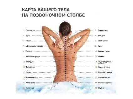 Корінцевий синдром поперекового відділу 5 симптомів і їх лікування (відділу) Корінцевий синдром поперекового відділу 5 симптомів і їх лікування