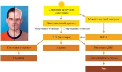Легка безсоння - бомба уповільненої дії - для організму (безсоння) Легка безсоння - бомба уповільненої дії - для організму