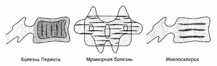Променева і інструментальна діагностика патології хребта (діагностика) Променева і інструментальна діагностика патології хребта