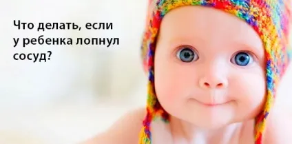 Лопнула судина в оці причини, лікування, симптоми (лопнула судина в оці) Лопнула судина в оці причини, лікування, симптоми