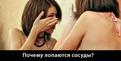 Лопнула судина в оці причини, лікування, симптоми (посудину) Лопнула судина в оці причини, лікування, симптоми