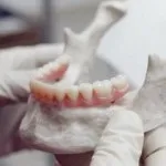 Металлопластмассовиє коронки протезування зубів металопластику (коронки) Металлопластмассовиє коронки протезування зубів металопластику