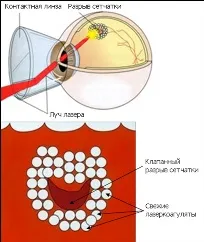 Міжнародний офтальмологічний центр (центр) Міжнародний офтальмологічний центр