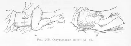 Мультікістоз нирок, Мультікістозная дисплазія у новонародженого (Мультікістозная) Мультікістоз нирок, Мультікістозная дисплазія у новонародженого
