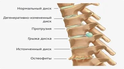 Чоловік опустив ноги в воду з содою на кілька хвилин (воду) Чоловік опустив ноги в воду з содою на кілька хвилин
