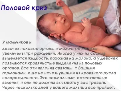 Набряклі молочні залози у новонароджених причини і лікування (лікування) Набряклі молочні залози у новонароджених причини і лікування