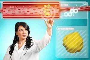 Народні засоби і ліки для зниження холестерину (зниження) Народні засоби і ліки для зниження холестерину