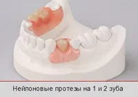 Нейлонові знімні зубні протези ціна і фото (valplast, quattro ti) (знімні) Нейлонові знімні зубні протези ціна і фото (valplast, quattro ti)
