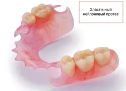 Нейлонові знімні зубні протези ціна і фото (valplast, quattro ti) (нейлонові) Нейлонові знімні зубні протези ціна і фото (valplast, quattro ti)