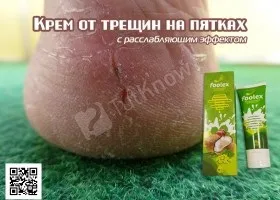 Огрубіла шкіра на п'ятах причини і догляд (ванночки) Огрубіла шкіра на п'ятах причини і догляд