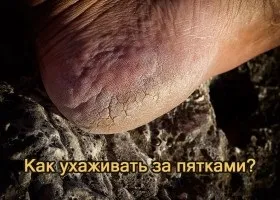 Огрубіла шкіра на п'ятах причини і догляд (догляд) Огрубіла шкіра на п'ятах причини і догляд