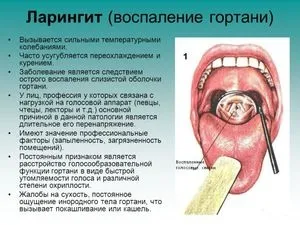 Чи небезпечний ларингіт для оточуючих заразний він чи ні