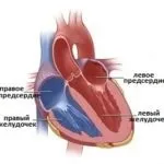 Органи мішені при гіпертонічній хворобі ураження при гіпертензії (гіпертензії) Органи мішені при гіпертонічній хворобі ураження при гіпертензії