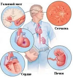 Органи мішені при гіпертонічній хворобі чим небезпечне високий тиск (органи) Органи мішені при гіпертонічній хворобі чим небезпечне високий тиск