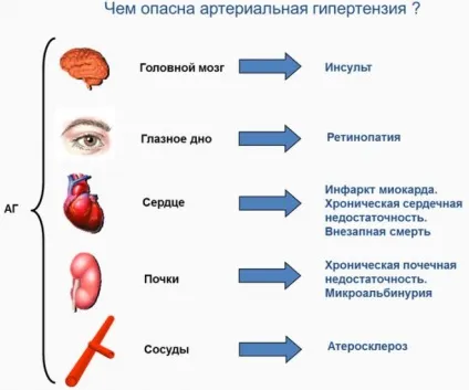 Органи мішені при гіпертонічній хворобі - визначення діагнозу (гіпертонічної) Органи мішені при гіпертонічній хворобі - визначення діагнозу