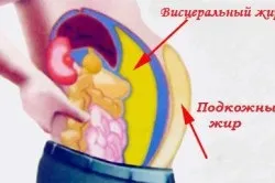 Ожиріння у чоловіків причини, види, лікування (ожиріння чоловіків чоловіче види лікування наслідки причини) Ожиріння у чоловіків причини, види, лікування
