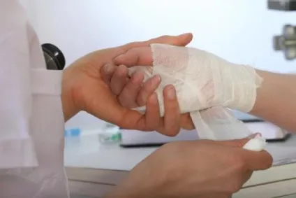 Опік третього ступеня ознаки, перша допомога, час лікування (третьої) Опік третього ступеня ознаки, перша допомога, час лікування