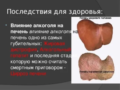 Печінка алкоголіка і здорової людини фото печінки питущого (питущого) Печінка алкоголіка і здорової людини фото печінки питущого