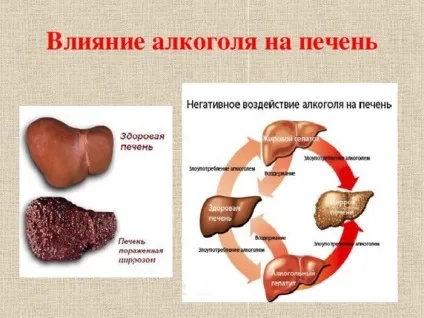 Печінка алкоголіка і здорової людини фото печінки питущого (печінки) Печінка алкоголіка і здорової людини фото печінки питущого