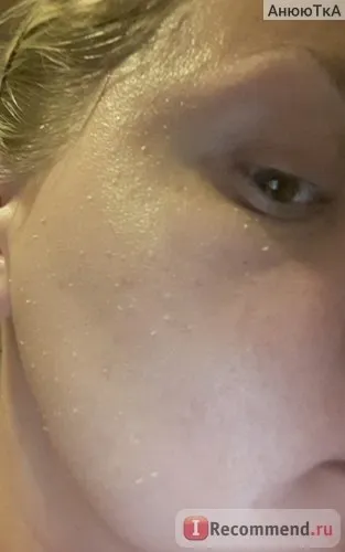 Пілінг для обличчя tony moly peeling me aloe soothing gel - «м'яке очищення шкіри від - tony moly (пілінг) Пілінг для обличчя tony moly peeling me aloe soothing gel - «м'яке очищення шкіри від - tony moly