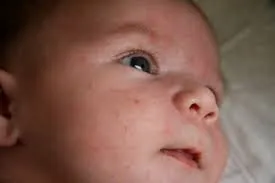 Чому з'являється висип на обличчі у дитини 1 місяць дрібна, алергічний висип (з'являється) Чому з'являється висип на обличчі у дитини 1 місяць дрібна, алергічний висип