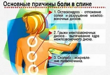 Чому ниє поперек у жінок причини, лікування, феломена (жінок) Чому ниє поперек у жінок причини, лікування, феломена