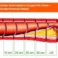 Чому виникає цукровий діабет