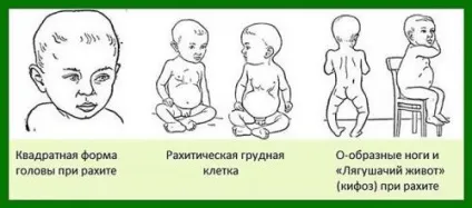 Чому зводить м'язи ніг під час сну судомою (м'язи) Чому зводить м'язи ніг під час сну судомою
