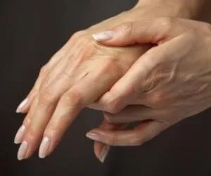 Поліартрит пальців рук симптоми, причини, лікування, відео та фото (лікування) Поліартрит пальців рук симптоми, причини, лікування, відео та фото
