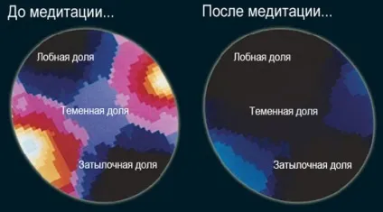 Користь від медитації - 10 способів допомогти вашому розуму (релаксація) Користь від медитації - 10 способів допомогти вашому розуму