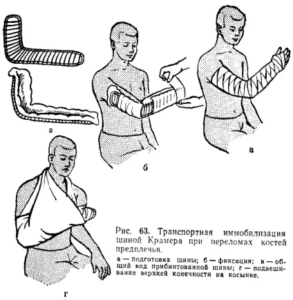 Портная іммобілізація матеріальне забезпечення (портная) Портная іммобілізація матеріальне забезпечення