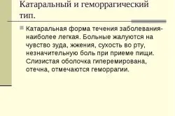 Поперековий герпес симптоми, причини, лікування (фото і відео) (симптоми) Поперековий герпес симптоми, причини, лікування (фото і відео)